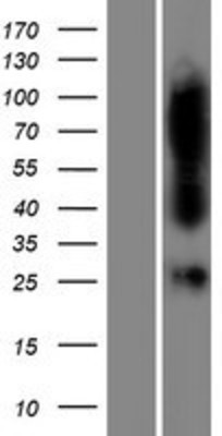 Western Blot: FAHD1 Overexpression Lysate (Adult Normal) [NBP2-08665] Left-Empty vector transfected control cell lysate (HEK293 cell lysate); Right -Over-expression Lysate for FAHD1.