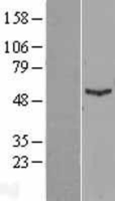 Western Blot: IFIT1 Overexpression Lysate (Adult Normal) [NBL1-11834] Left-Empty vector transfected control cell lysate (HEK293 cell lysate); Right -Over-expression Lysate for IFIT1.
