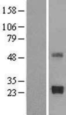 Western Blot: TIMP2 Overexpression Lysate (Adult Normal) [NBL1-16925] Left-Empty vector transfected control cell lysate (HEK293 cell lysate); Right -Over-expression Lysate for TIMP2.