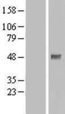Western Blot: PDPK1 Overexpression Lysate (Adult Normal) [NBL1-14260] Left-Empty vector transfected control cell lysate (HEK293 cell lysate); Right -Over-expression Lysate for PDPK1.