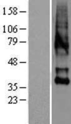 Western Blot: Oxytocin Receptor Overexpression Lysate (Adult Normal) [NBL1-14027] Left-Empty vector transfected control cell lysate (HEK293 cell lysate); Right -Over-expression Lysate for Oxytocin Receptor.