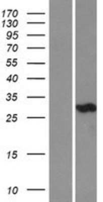 Western Blot: Carbonic Anhydrase III Overexpression Lysate (Adult Normal) [NBL1-08616] Left-Empty vector transfected control cell lysate (HEK293 cell lysate); Right -Over-expression Lysate for Carbonic Anhydrase III.
