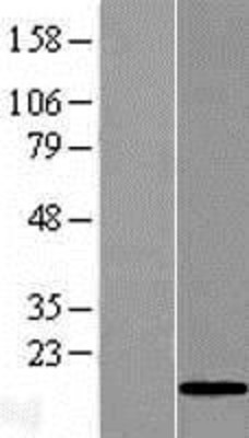 Western Blot: GOLGA7B Overexpression Lysate (Adult Normal) [NBL1-08074] Left-Empty vector transfected control cell lysate (HEK293 cell lysate); Right -Over-expression Lysate for GOLGA7B.