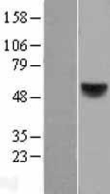 Western Blot: Retinoic Acid Receptor beta Overexpression Lysate (Adult Normal) [NBL1-15157] Left-Empty vector transfected control cell lysate (HEK293 cell lysate); Right -Over-expression Lysate for Retinoic Acid Receptor beta.