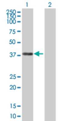 Lane 1: PLA2G4B transfected lysate (35.9 KDa) Lane 2: Non-transfected lysate.