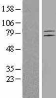 Western Blot: ETL Overexpression Lysate (Adult Normal) [NBL1-10251] Left-Empty vector transfected control cell lysate (HEK293 cell lysate); Right -Over-expression Lysate for ETL.