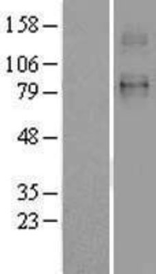 Western Blot: SLC26A2 Overexpression Lysate (Adult Normal) [NBL1-16076] Left-Empty vector transfected control cell lysate (HEK293 cell lysate); Right -Over-expression Lysate for SLC26A2.