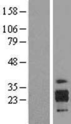 Western Blot: ICAM4 Overexpression Lysate (Adult Normal) [NBL1-11808] Left-Empty vector transfected control cell lysate (HEK293 cell lysate); Right -Over-expression Lysate for ICAM4.