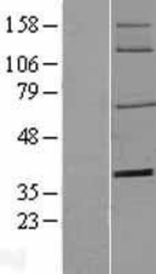 Western Blot: CD73 Overexpression Lysate (Adult Normal) [NBL1-13827] Left-Empty vector transfected control cell lysate (HEK293 cell lysate); Right -Over-expression Lysate for CD73.
