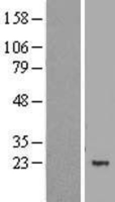 Western Blot: MBD3L1 Overexpression Lysate (Adult Normal) [NBL1-12925] Left-Empty vector transfected control cell lysate (HEK293 cell lysate); Right -Over-expression Lysate for MBD3L1.