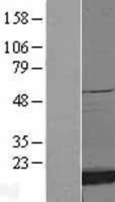 Western Blot: Superoxide Dismutase 1 Overexpression Lysate (Adult Normal) [NBL1-16332] Left-Empty vector transfected control cell lysate (HEK293 cell lysate); Right -Over-expression Lysate for Superoxide Dismutase 1.