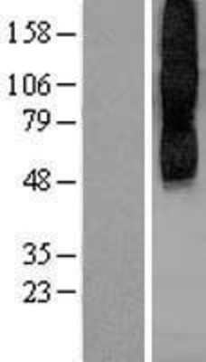 Western Blot: Muscarinic Acetylcholine Receptor 2 Overexpression Lysate (Adult Normal) [NBP2-08824] Left-Empty vector transfected control cell lysate (HEK293 cell lysate); Right -Over-expression Lysate for Muscarinic Acetylcholine Receptor 2.