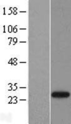 Western Blot: SENP8 Overexpression Lysate (Adult Normal) [NBL1-15813] Left-Empty vector transfected control cell lysate (HEK293 cell lysate); Right -Over-expression Lysate for SENP8.