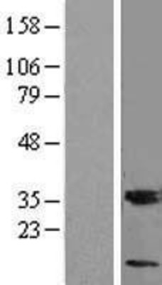 Western Blot: MGST3 Overexpression Lysate (Adult Normal) [NBL1-13095] Left-Empty vector transfected control cell lysate (HEK293 cell lysate); Right -Over-expression Lysate for MGST3.