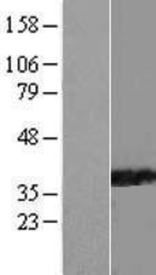Western Blot: PPIL6 Overexpression Lysate (Adult Normal) [NBL1-14655] Left-Empty vector transfected control cell lysate (HEK293 cell lysate); Right -Over-expression Lysate for PPIL6.