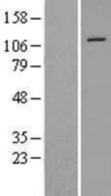 Western Blot: NALP12 Overexpression Lysate (Adult Normal) [NBL1-13673] Left-Empty vector transfected control cell lysate (HEK293 cell lysate); Right -Over-expression Lysate for NALP12.