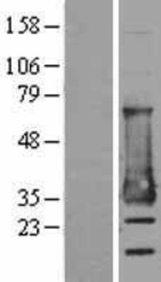 Western Blot: MESDC2 Overexpression Lysate (Adult Normal) [NBL1-13014] Left-Empty vector transfected control cell lysate (HEK293 cell lysate); Right -Over-expression Lysate for MESDC2.