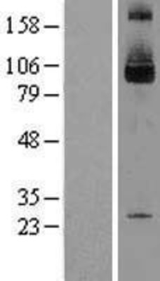 Western Blot: SKI Overexpression Lysate (Adult Normal) [NBL1-15989] Left-Empty vector transfected control cell lysate (HEK293 cell lysate); Right -Over-expression Lysate for SKI.