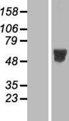 Western Blot: MNK2 Overexpression Lysate (Adult Normal) [NBL1-13124] Left-Empty vector transfected control cell lysate (HEK293 cell lysate); Right -Over-expression Lysate for MNK2.