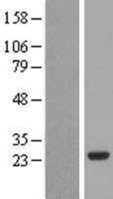 Western Blot: PCTP Overexpression Lysate (Adult Normal) [NBL1-14197] Left-Empty vector transfected control cell lysate (HEK293 cell lysate); Right -Over-expression Lysate for PCTP.