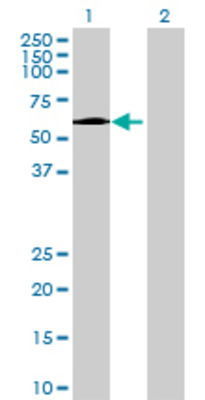 Lane 1: GPT2 transfected lysate (57.64 KDa) Lane 2: Non-transfected lysate.