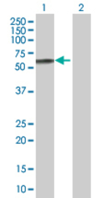 Lane 1: CACNB4 transfected lysate (58.2 KDa) Lane 2: Non-transfected lysate.