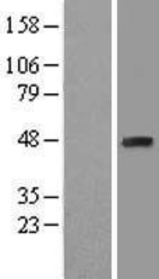 Western Blot: EBP1 Overexpression Lysate (Adult Normal) [NBL1-14055] Left-Empty vector transfected control cell lysate (HEK293 cell lysate); Right -Over-expression Lysate for EBP1.