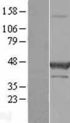 Western Blot: DAP Kinase 2 Overexpression Lysate (Adult Normal) [NBL1-09717] Left-Empty vector transfected control cell lysate (HEK293 cell lysate); Right -Over-expression Lysate for DAP Kinase 2.