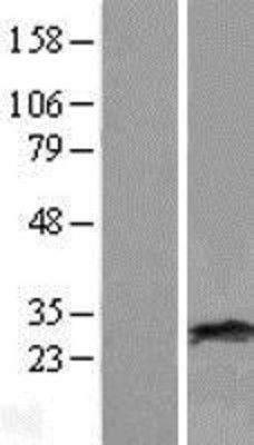 Western Blot: RAB38 Overexpression Lysate (Adult Normal) [NBL1-15068] Left-Empty vector transfected control cell lysate (HEK293 cell lysate); Right -Over-expression Lysate for RAB38.