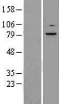 Western Blot: RSK3 Overexpression Lysate (Adult Normal) [NBL1-15571] Left-Empty vector transfected control cell lysate (HEK293 cell lysate); Right -Over-expression Lysate for RSK3.