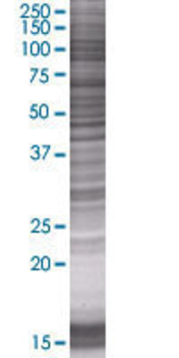 GPT2 transfected lysate.