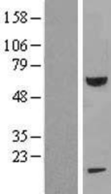 Western Blot: FEM1B Overexpression Lysate (Adult Normal) [NBL1-10674] Left-Empty vector transfected control cell lysate (HEK293 cell lysate); Right -Over-expression Lysate for FEM1B.