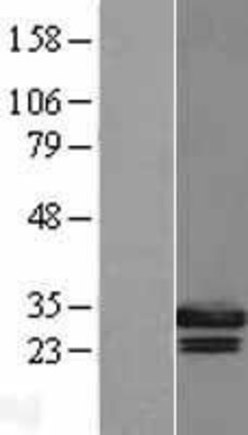 Western Blot: Geminin Overexpression Lysate (Adult Normal) [NBL1-11143] Left-Empty vector transfected control cell lysate (HEK293 cell lysate); Right -Over-expression Lysate for Geminin.