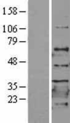 Western Blot: DRAP1 Overexpression Lysate (Adult Normal) [NBL1-10014] Left-Empty vector transfected control cell lysate (HEK293 cell lysate); Right -Over-expression Lysate for DRAP1.