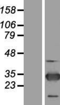 Western Blot: ZNF313 Overexpression Lysate (Adult Normal) [NBL1-15413] Left-Empty vector transfected control cell lysate (HEK293 cell lysate); Right -Over-expression Lysate for ZNF313.