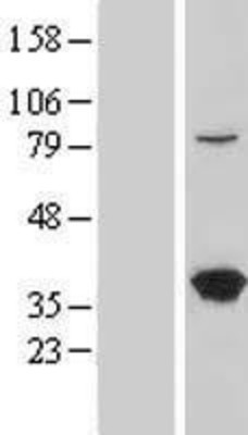 Western Blot: LZTFL1 Overexpression Lysate (Adult Normal) [NBL1-12776] Left-Empty vector transfected control cell lysate (HEK293 cell lysate); Right -Over-expression Lysate for LZTFL1.