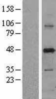 Western Blot: PUS1 Overexpression Lysate (Adult Normal) [NBL1-14996] Left-Empty vector transfected control cell lysate (HEK293 cell lysate); Right -Over-expression Lysate for PUS1.
