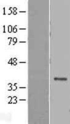 Western Blot: DEDD Overexpression Lysate (Adult Normal) [NBL1-09814] Left-Empty vector transfected control cell lysate (HEK293 cell lysate); Right -Over-expression Lysate for DEDD.
