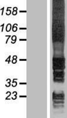 Western Blot: Signal Peptide Peptidase Overexpression Lysate (Adult Normal) [NBL1-11602] Left-Empty vector transfected control cell lysate (HEK293 cell lysate); Right -Over-expression Lysate for Signal Peptide Peptidase.