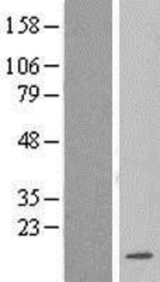 Western Blot: LSM3 Overexpression Lysate (Adult Normal) [NBL1-12726] Left-Empty vector transfected control cell lysate (HEK293 cell lysate); Right -Over-expression Lysate for LSM3.