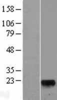 Western Blot: GLYAT Overexpression Lysate (Adult Normal) [NBL1-11133] Left-Empty vector transfected control cell lysate (HEK293 cell lysate); Right -Over-expression Lysate for GLYAT.