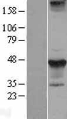 Western Blot: Styk1 Overexpression Lysate (Adult Normal) [NBL1-16590] Left-Empty vector transfected control cell lysate (HEK293 cell lysate); Right -Over-expression Lysate for Styk1.