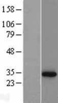 Western Blot: NQO1 Overexpression Lysate (Adult Normal) [NBL1-13761] Left-Empty vector transfected control cell lysate (HEK293 cell lysate); Right -Over-expression Lysate for NQO1.