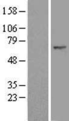 Western Blot: FBXW11 Overexpression Lysate (Adult Normal) [NBL1-10644] Left-Empty vector transfected control cell lysate (HEK293 cell lysate); Right -Over-expression Lysate for FBXW11.