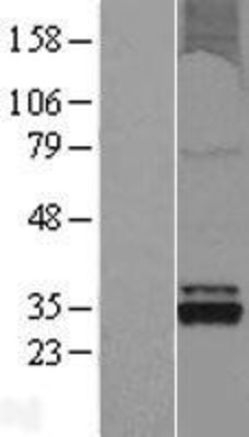 Western Blot: OXNAD1 Overexpression Lysate (Adult Normal) [NBL1-14022] Left-Empty vector transfected control cell lysate (HEK293 cell lysate); Right -Over-expression Lysate for OXNAD1.
