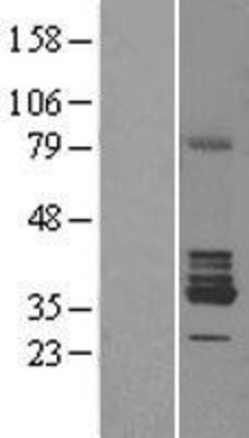 Western Blot: RDH5 Overexpression Lysate (Adult Normal) [NBL1-15259] Left-Empty vector transfected control cell lysate (HEK293 cell lysate); Right -Over-expression Lysate for RDH5.