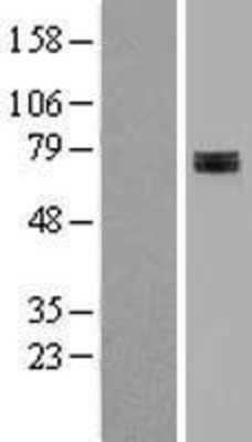 Western Blot: SDHA Overexpression Lysate (Adult Normal) [NBL1-15765] Left-Empty vector transfected control cell lysate (HEK293 cell lysate); Right -Over-expression Lysate for SDHA.