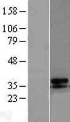 Western Blot: UCP3 Overexpression Lysate (Adult Normal) [NBL1-17583] Left-Empty vector transfected control cell lysate (HEK293 cell lysate); Right -Over-expression Lysate for UCP3.