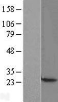 Western Blot: CBX3 Overexpression Lysate (Adult Normal) [NBL1-08748] Left-Empty vector transfected control cell lysate (HEK293 cell lysate); Right -Over-expression Lysate for CBX3.