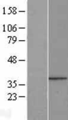 Western Blot: PPP1R3B Overexpression Lysate (Adult Normal) [NBL1-14683] Left-Empty vector transfected control cell lysate (HEK293 cell lysate); Right -Over-expression Lysate for PPP1R3B.